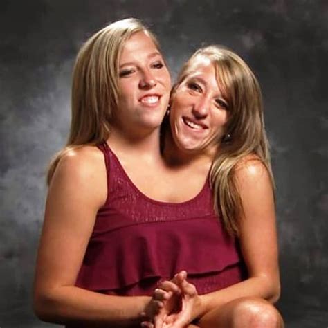 Conjoined twins brittany and abby married  They majored in their